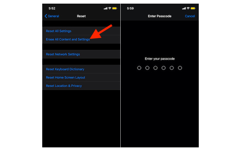 Chọn Erase All Content and Settings Chọn Erase All Content and Settings